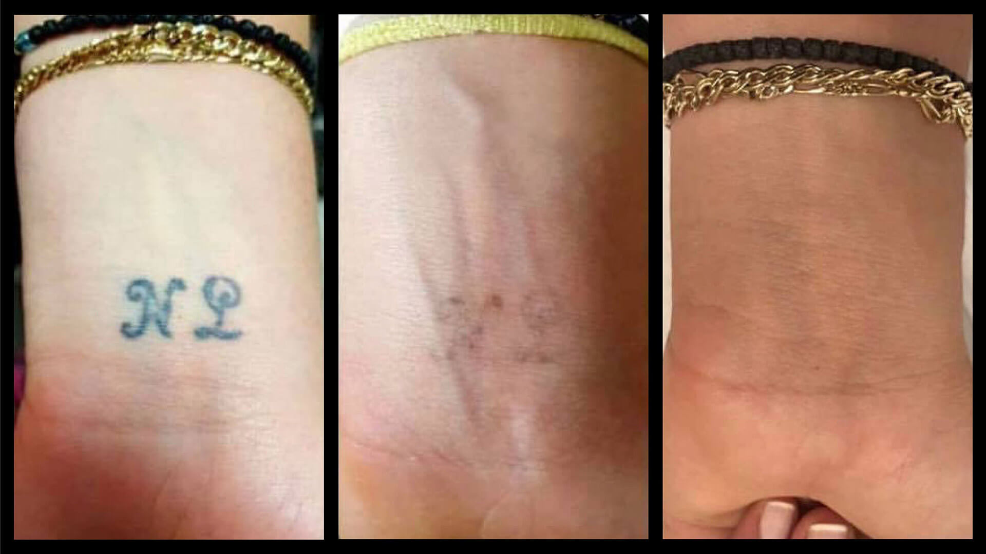 Tattoo Removal Cream Natural Fading system wrecking balm 2 week spartan  perform : Beauty & Personal Care - Amazon.com